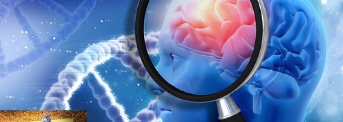 Degli stili di vita consigliati per prevenire  il morbo di Alzheimer e di qualche altra curiosità