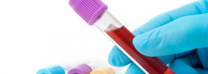 Prevenzione con i check-up del Poliambulatorio Valturio
