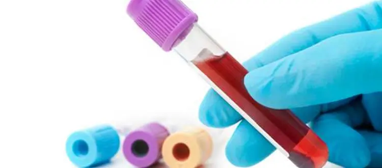 Prevenzione con i check-up del Poliambulatorio Valturio