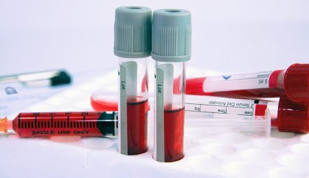 Ematologia