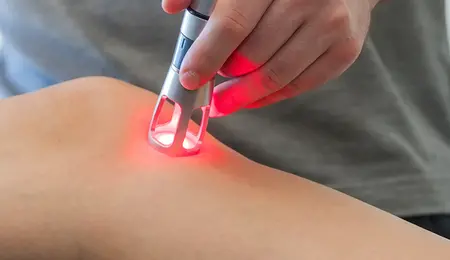 Laserterapia