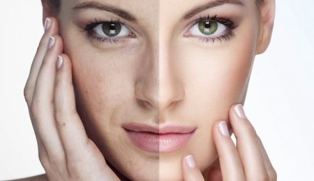 Medicina estetica e antiaging