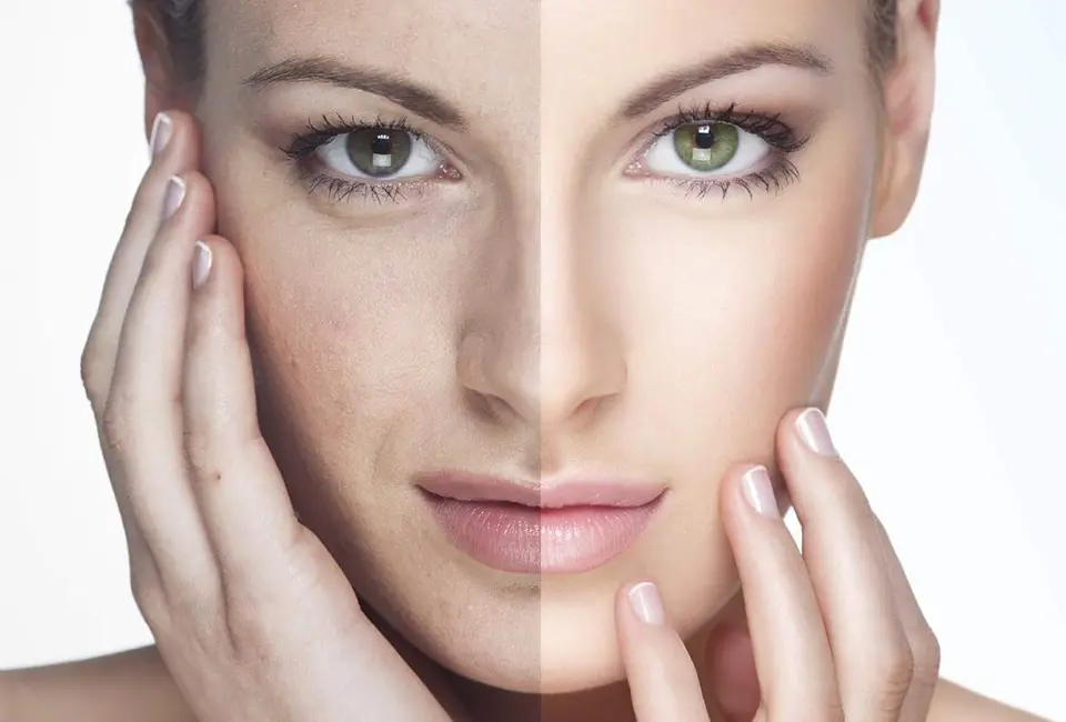 Medicina estetica e antiaging Medicina estetica e antiaging